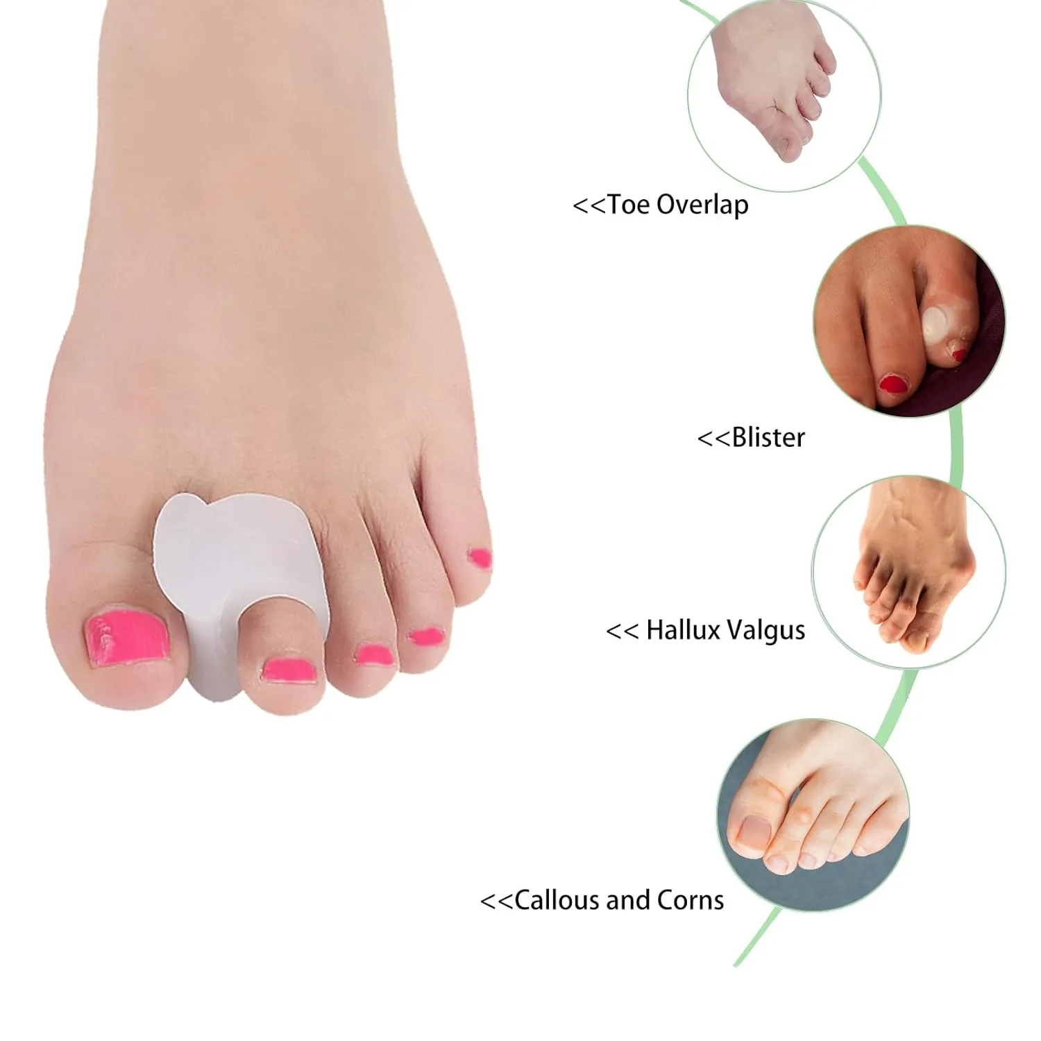 New Misorita Gel Toe Spacers 10pcs, Toe Separators for Men and Women, Toe Straightener Toe Spreaders Correct Bunion Hammer toe Overlapping Toes